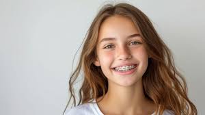 importance of braces for teenagers