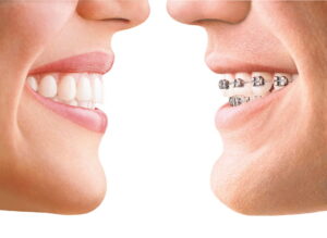 Orthodontist Edison NJ