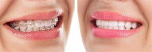 Orthodontist Edison NJ