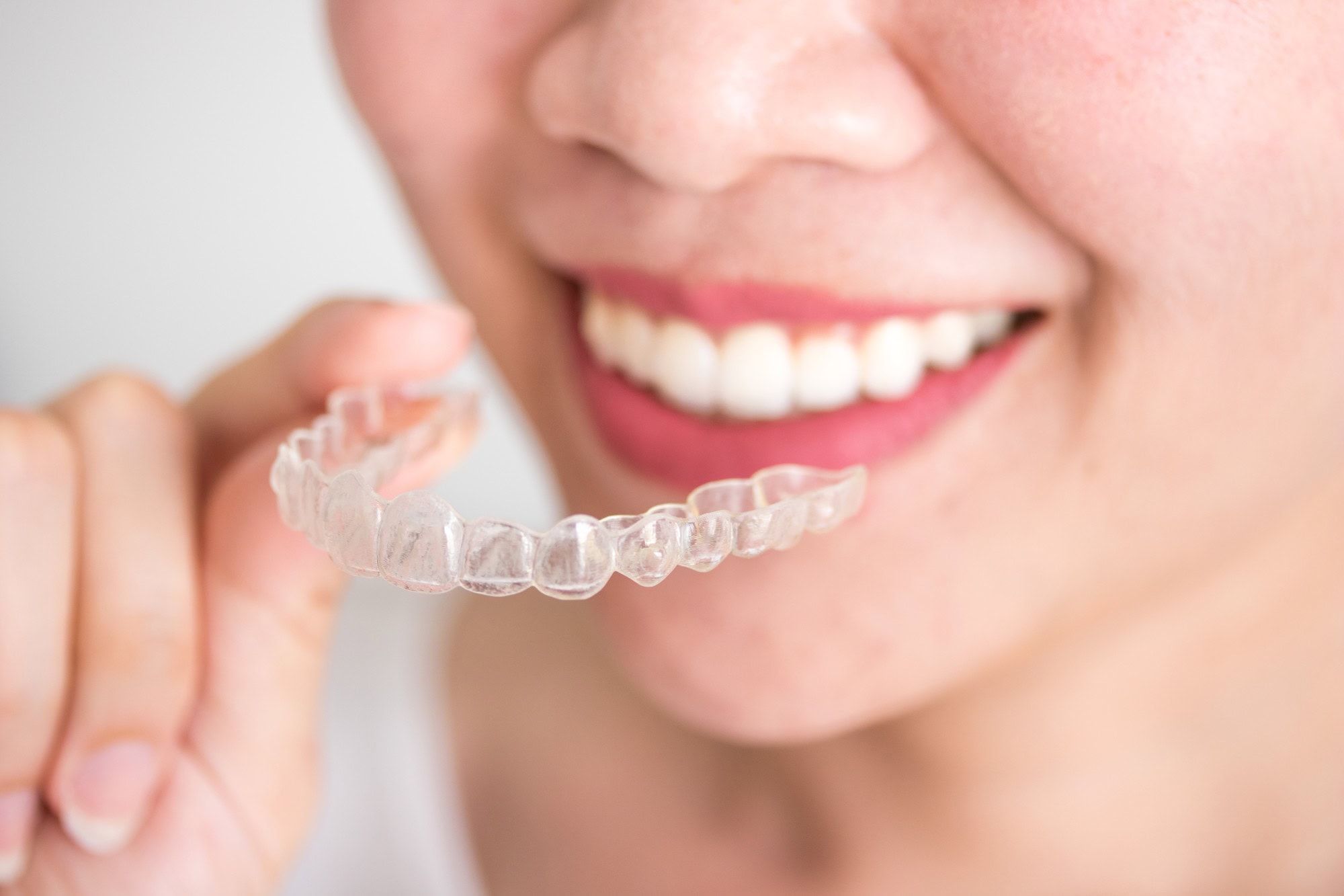 Invisalign cost Edison