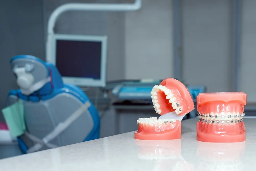 how do braces work