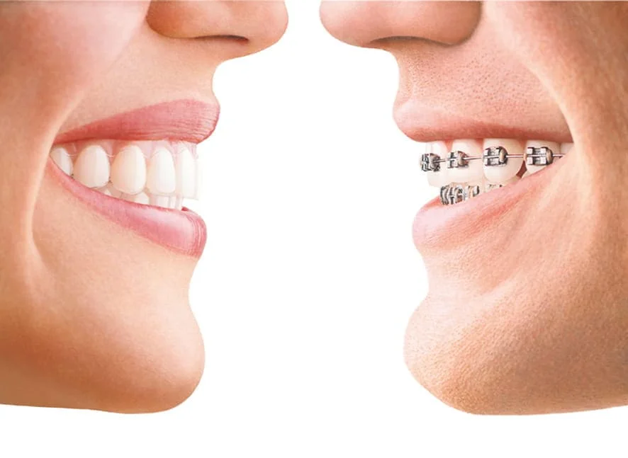 Orthodontist Edison NJ